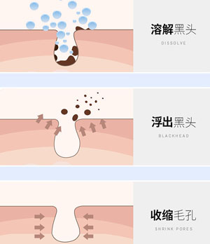 去黑头磨皮鼻贴